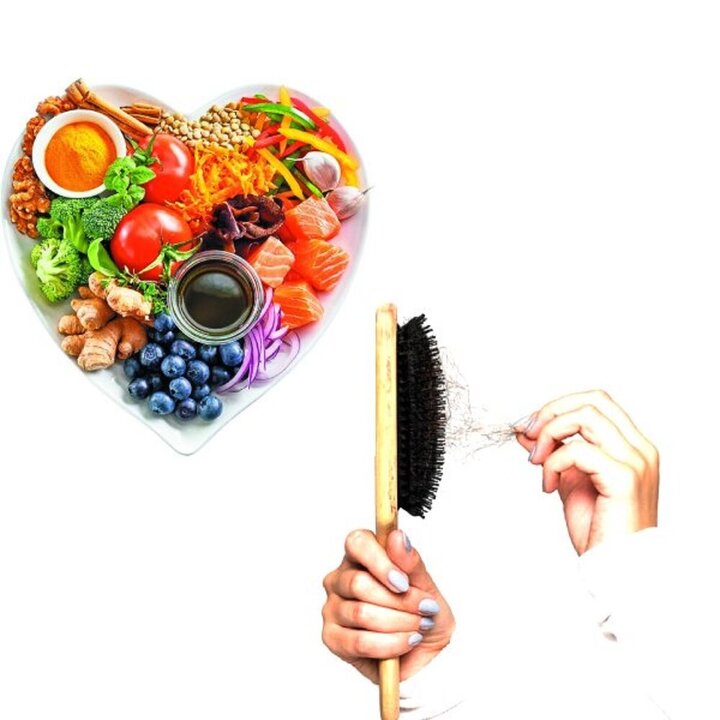 چه ارتباطی بین رژیم غذایی و ریزش مو وجود دارد؟